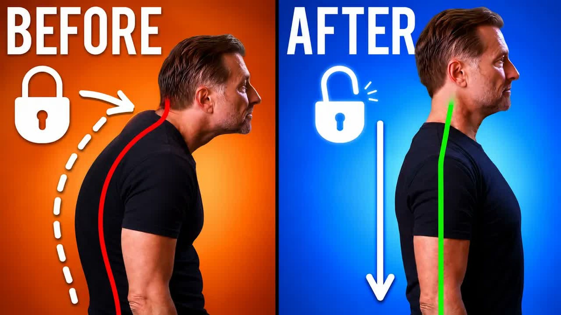 TKD23-How to Actually Fix a Hunchback Why Stretches Aren t Working - The Knowledge Doc