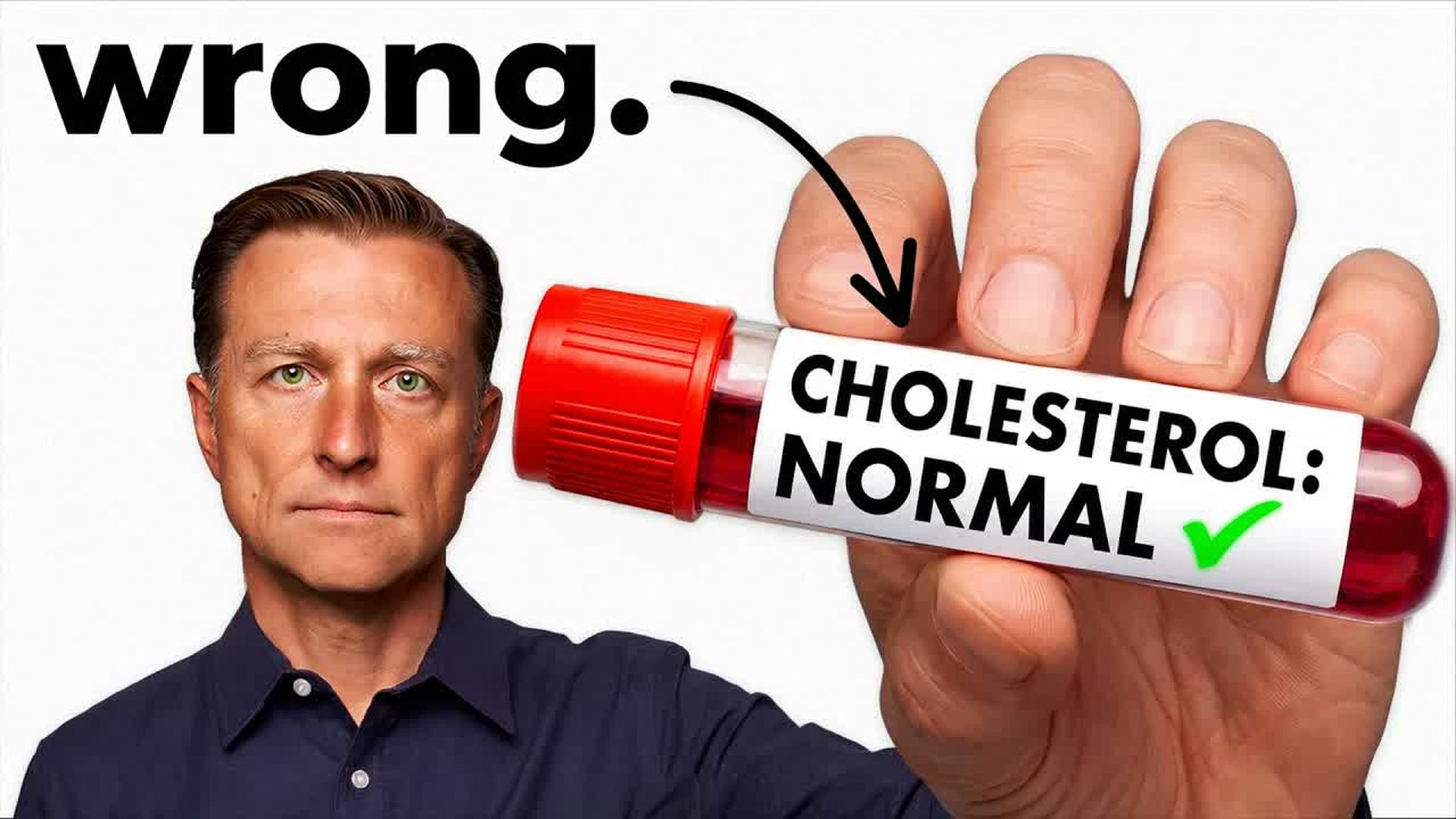 TKD12-What is Normal Cholesterol What Your Doctor Doesn t Tell You - The Knowledge Doc