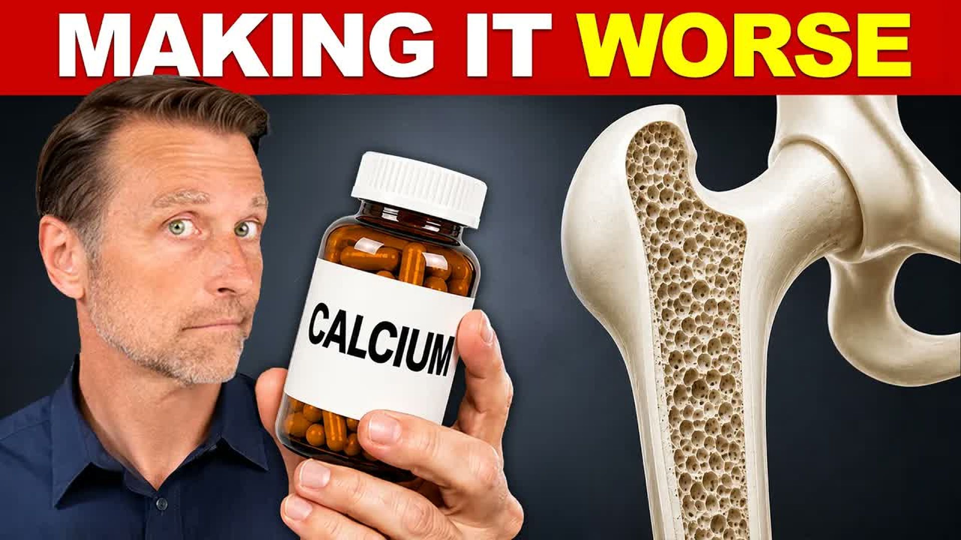 TKD10-Osteoporosis Isn t a Calcium Deficiency Doctors Get This Wrong - The Knowledge Doc